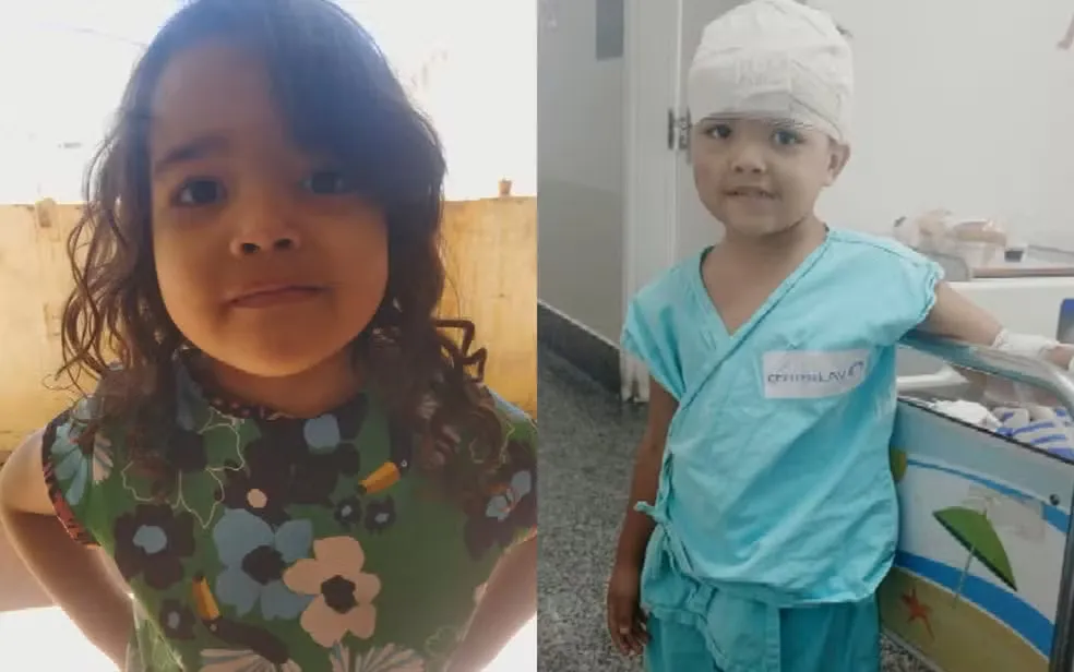 A menina Evellyn Catheryne, de 4 anos, foi atacada por um pit bull dentro de casa, em Goiânia — Foto: Reprodução/TV Anhanguera