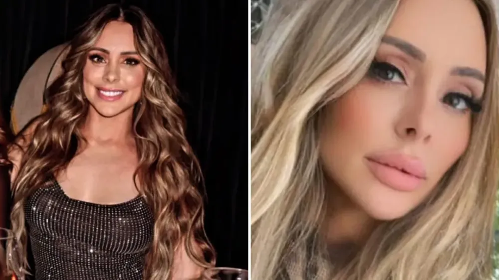 Andreia morreu após realizar cirurgias plásticas nas regiões do rosto e do pescoço. • Reprodução/Redes sociais