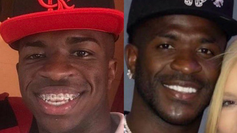Antes e depois da harmonização facial de Vini Jr • X/Reprodução