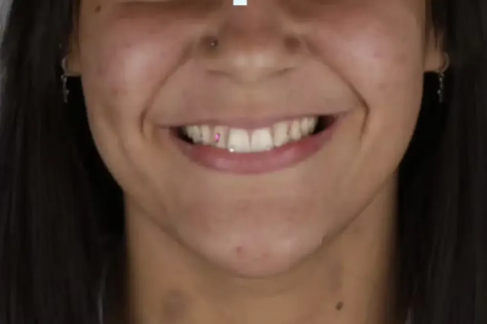 Uma jovem de 18 anos foi presa em flagrante pela Polícia Militar no município de Trindade, localizado na Região Metropolitana de Goiânia, suspeita de aplicar um calote em um consultório odontológico. A mulher realizou a aplicação de cristais estéticos nos